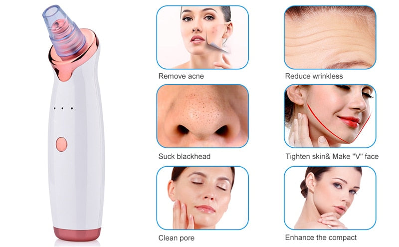 VacBlack - Premium Blackhead Vacuum Remover Set